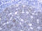 Mucin 16, Cell Surface Associated antibody, LS-C336339, Lifespan Biosciences, Immunohistochemistry frozen image 