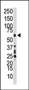 Mitogen-Activated Protein Kinase Kinase Kinase 7 antibody, AP14838PU-N, Origene, Western Blot image 