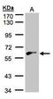 Glycerol Kinase 2 antibody, GTX107563, GeneTex, Western Blot image 