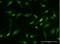 GLI Family Zinc Finger 1 antibody, H00002735-M21-100ug, Novus Biologicals, Immunofluorescence image 