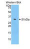Interleukin 17 Receptor D antibody, LS-C294859, Lifespan Biosciences, Western Blot image 