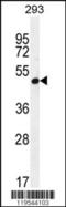 Alpha 1,4-Galactosyltransferase (P Blood Group) antibody, 55-043, ProSci, Western Blot image 