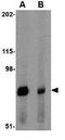 CD49D antibody, GTX31781, GeneTex, Western Blot image 