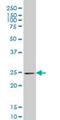 Phosphoserine Phosphatase antibody, H00005723-M06, Novus Biologicals, Western Blot image 