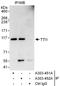 TELO2 Interacting Protein 1 antibody, A303-452A, Bethyl Labs, Immunoprecipitation image 