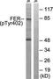 Cancer Susceptibility 4 antibody, orb314214, Biorbyt, Western Blot image 