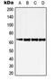 Zinc Finger Protein 460 antibody, orb215015, Biorbyt, Western Blot image 