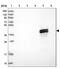 Betaine--Homocysteine S-Methyltransferase 2 antibody, NBP1-85826, Novus Biologicals, Western Blot image 