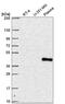 SPT7 Like, STAGA Complex Gamma Subunit antibody, NBP2-57671, Novus Biologicals, Western Blot image 