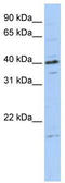 Tubulin Polymerization Promoting Protein Family Member 3 antibody, TA344122, Origene, Western Blot image 