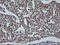 ETS Proto-Oncogene 2, Transcription Factor antibody, M02641, Boster Biological Technology, Immunohistochemistry paraffin image 