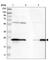 Glutathione S-Transferase Pi 1 antibody, HPA019869, Atlas Antibodies, Western Blot image 