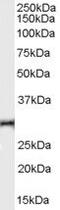 TNF Receptor Superfamily Member 14 antibody, PA5-18451, Invitrogen Antibodies, Western Blot image 
