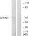 Acetylcholine Receptor antibody, LS-C120626, Lifespan Biosciences, Western Blot image 