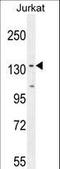 Protein Phosphatase 1 Regulatory Subunit 3A antibody, LS-C162082, Lifespan Biosciences, Western Blot image 