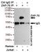 Zeta Chain Of T Cell Receptor Associated Protein Kinase 70 antibody, STJ99214, St John