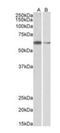 Ariadne RBR E3 Ubiquitin Protein Ligase 2 antibody, orb18817, Biorbyt, Western Blot image 