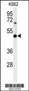 Beta-1,3-Glucuronyltransferase 1 antibody, 64-189, ProSci, Western Blot image 