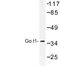 G Protein Subunit Alpha Transducin 1 antibody, LS-C177459, Lifespan Biosciences, Western Blot image 