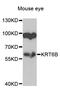 Keratin 6B antibody, STJ110009, St John