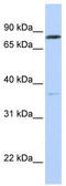 Orthodenticle Homeobox 1 antibody, TA330282, Origene, Western Blot image 