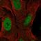 Zinc Finger Protein 296 antibody, HPA049576, Atlas Antibodies, Immunocytochemistry image 