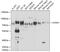 Ataxin 1 antibody, GTX30078, GeneTex, Western Blot image 