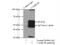 Calcium/Calmodulin Dependent Protein Kinase II Beta antibody, 11533-1-AP, Proteintech Group, Immunoprecipitation image 