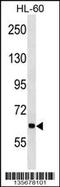 Ankyrin Repeat And KH Domain Containing 1 antibody, 58-334, ProSci, Western Blot image 