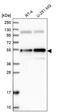 Ankyrin Repeat Domain 10 antibody, PA5-58577, Invitrogen Antibodies, Western Blot image 