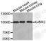 KN motif and ankyrin repeat domain-containing protein 2 antibody, A3406, ABclonal Technology, Western Blot image 