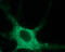 Sodium Voltage-Gated Channel Alpha Subunit 9 antibody, GTX54800, GeneTex, Immunocytochemistry image 