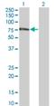 Zinc Finger Protein 18 antibody, H00007566-M01, Novus Biologicals, Western Blot image 