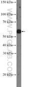 N-Sulfoglucosamine Sulfohydrolase antibody, 14184-1-AP, Proteintech Group, Western Blot image 