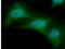 Ubiquitin Conjugating Enzyme E2 L6 antibody, NBP1-04351, Novus Biologicals, Immunocytochemistry image 