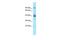 L3MBTL Histone Methyl-Lysine Binding Protein 3 antibody, PA5-43622, Invitrogen Antibodies, Western Blot image 