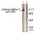 Catenin Delta 1 antibody, LS-C198741, Lifespan Biosciences, Western Blot image 