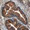 Androgen Receptor antibody, MAB58761, R&D Systems, Immunohistochemistry paraffin image 