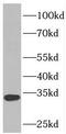 Phosducin Like 2 antibody, FNab06246, FineTest, Western Blot image 