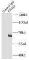 Epoxide Hydrolase 2 antibody, FNab02811, FineTest, Immunoprecipitation image 