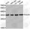 Egl-9 Family Hypoxia Inducible Factor 3 antibody, A2335, ABclonal Technology, Western Blot image 