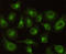 Carbonyl Reductase 1 antibody, STJ99164, St John