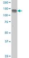 AXL Receptor Tyrosine Kinase antibody, H00000558-M02, Novus Biologicals, Western Blot image 