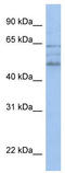 MSS51 Mitochondrial Translational Activator antibody, TA339646, Origene, Western Blot image 