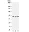 HLA class I histocompatibility antigen, A-2 alpha chain antibody, R31867, NSJ Bioreagents, Western Blot image 