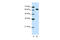 DIS3 Like 3'-5' Exoribonuclease 2 antibody, ARP41145_T100, Aviva Systems Biology, Western Blot image 
