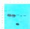 Tumor Protein P63 antibody, orb11214, Biorbyt, Western Blot image 