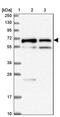 Transmembrane Protein 200C antibody, PA5-61480, Invitrogen Antibodies, Western Blot image 