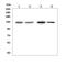 ATPase Phospholipid Transporting 11C antibody, A06516-1, Boster Biological Technology, Western Blot image 