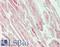 Solute Carrier Family 25 Member 11 antibody, LS-B13614, Lifespan Biosciences, Immunohistochemistry paraffin image 